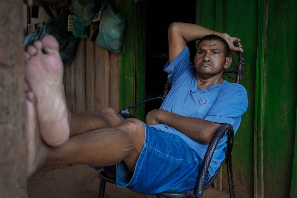 Zé Carlos parou de trabalhar em razão das fortes dores de cabeça causadas pela bala alojada atrás do olho (Foto: Fernando Martinho/Repórter Brasil)